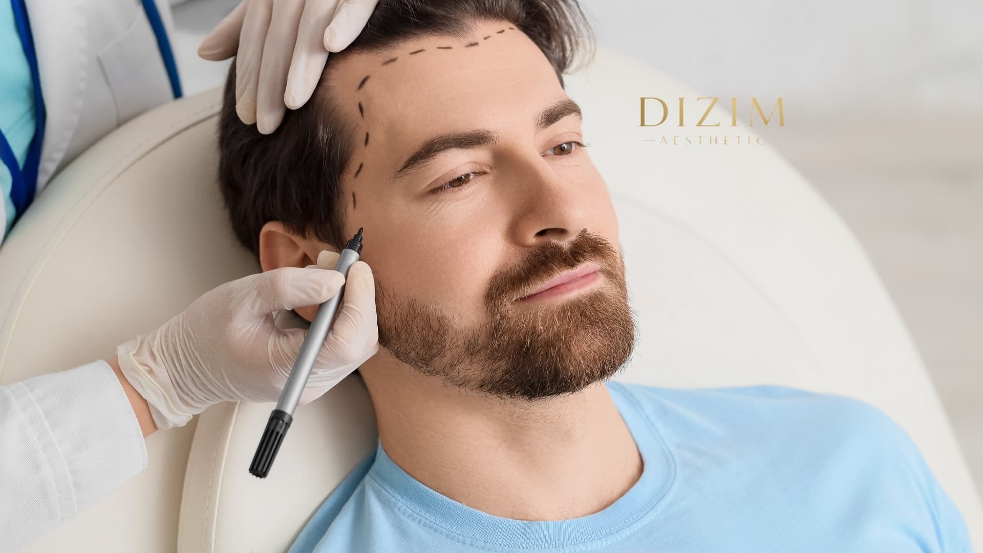 Haartransplantation in Frankfurt: Kosten, Ablauf und Methoden